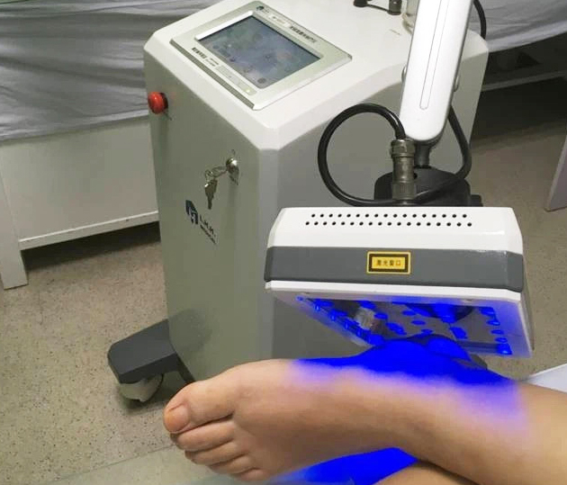 理疗:半导体激光